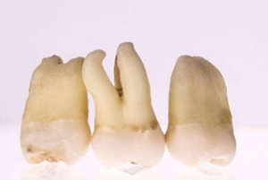 点点王者荣耀多样品组织研磨仪参与武汉大学中南医院法医司法鉴定